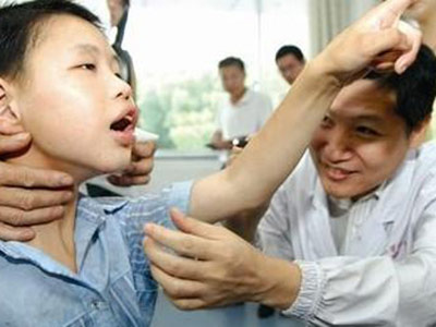 小孩癫痫病发作该怎么办